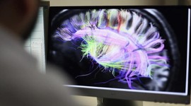 Beyin kanserine yakalandı: 14 ay ömrü kaldı