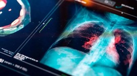 Kanser ilacı geliştirmek için 11 milyar dolarlık ortaklık