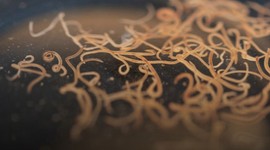 Ölümcül parazit alarmı!