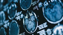 5,5 ay daha hızlı yaşlanıyormuşuz!