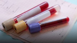 50’den fazla kanser türünü tespit eden kan testi