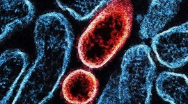 Nipah virüsü Asya ülkelerini alarma geçirdi!