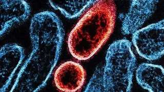 Nipah virüsü Asya ülkelerini alarma geçirdi!