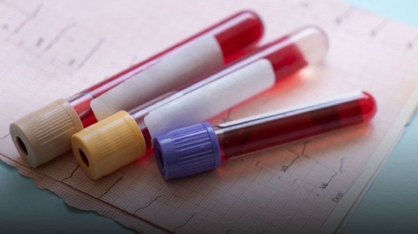 50’den fazla kanser türünü tespit eden kan testi